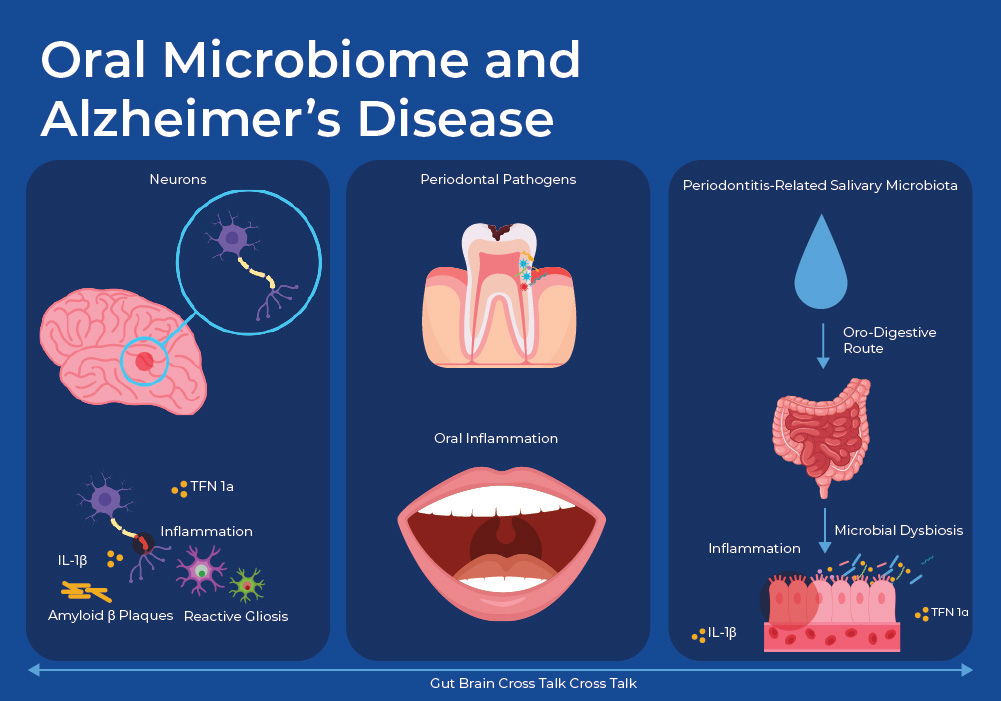 Figure 4 - Oral Microbiome and Alzheimers Disease